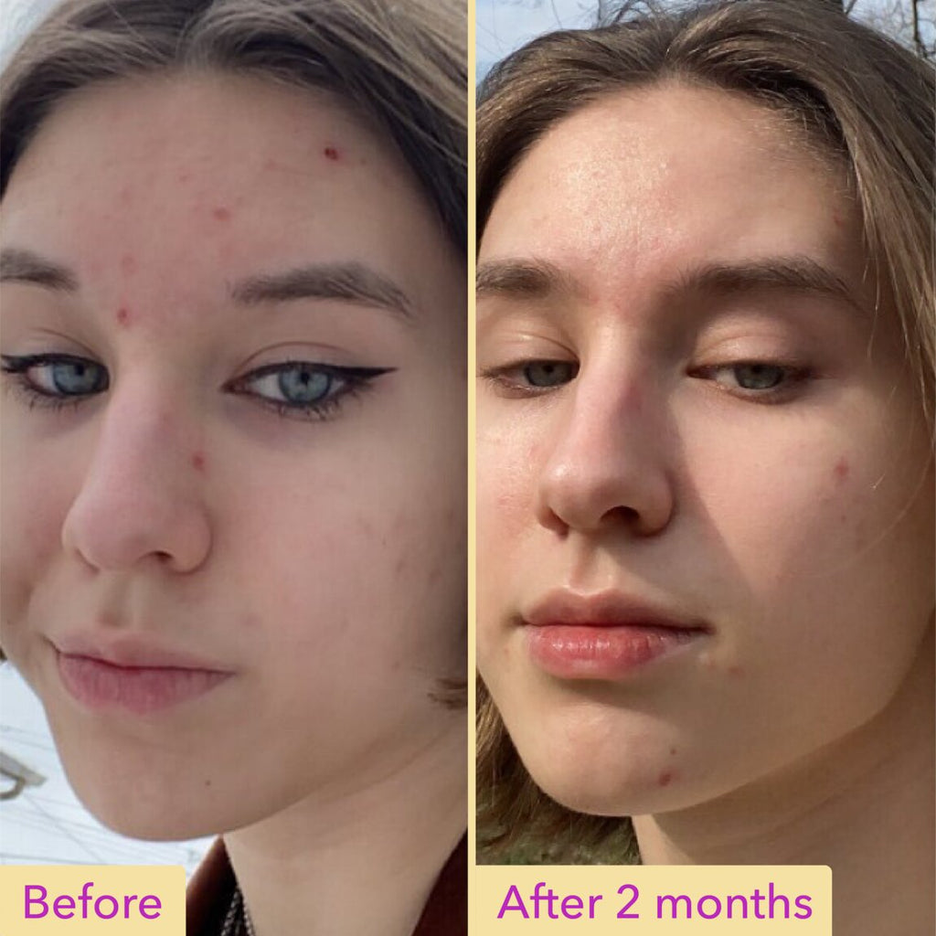 Niacinamide Serum M9