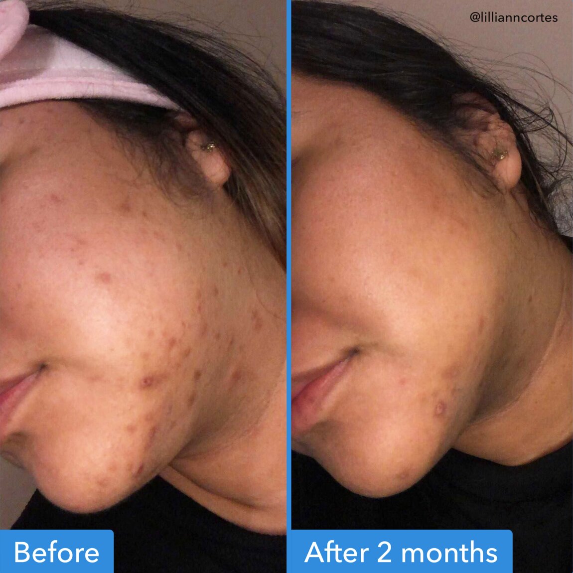 Discoloration Correcting Serum P8