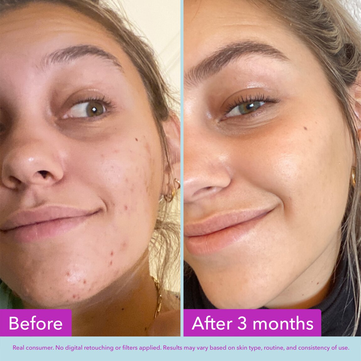 Niacinamide Brightening Toner T4