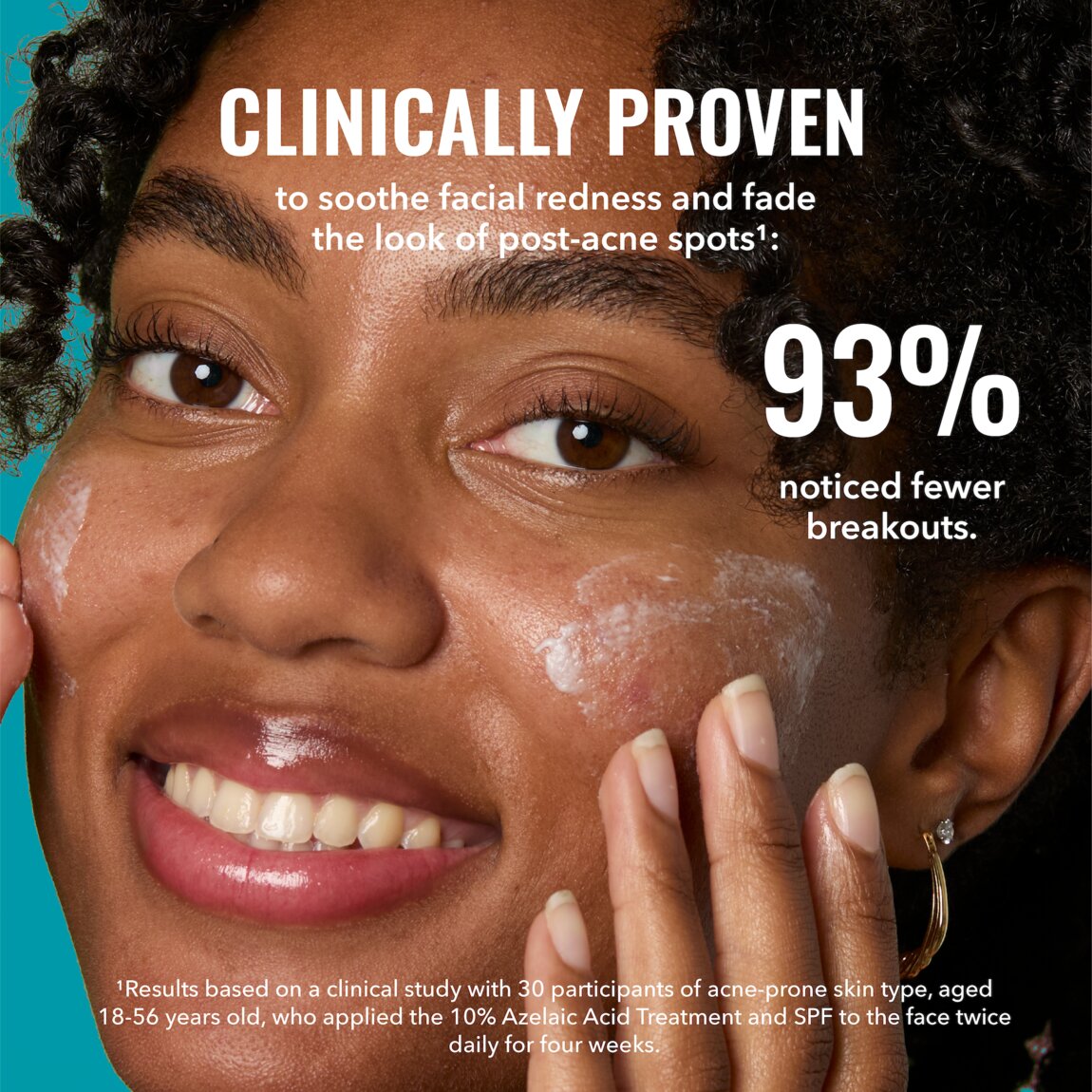 10% Azelaic Acid Treatment K6