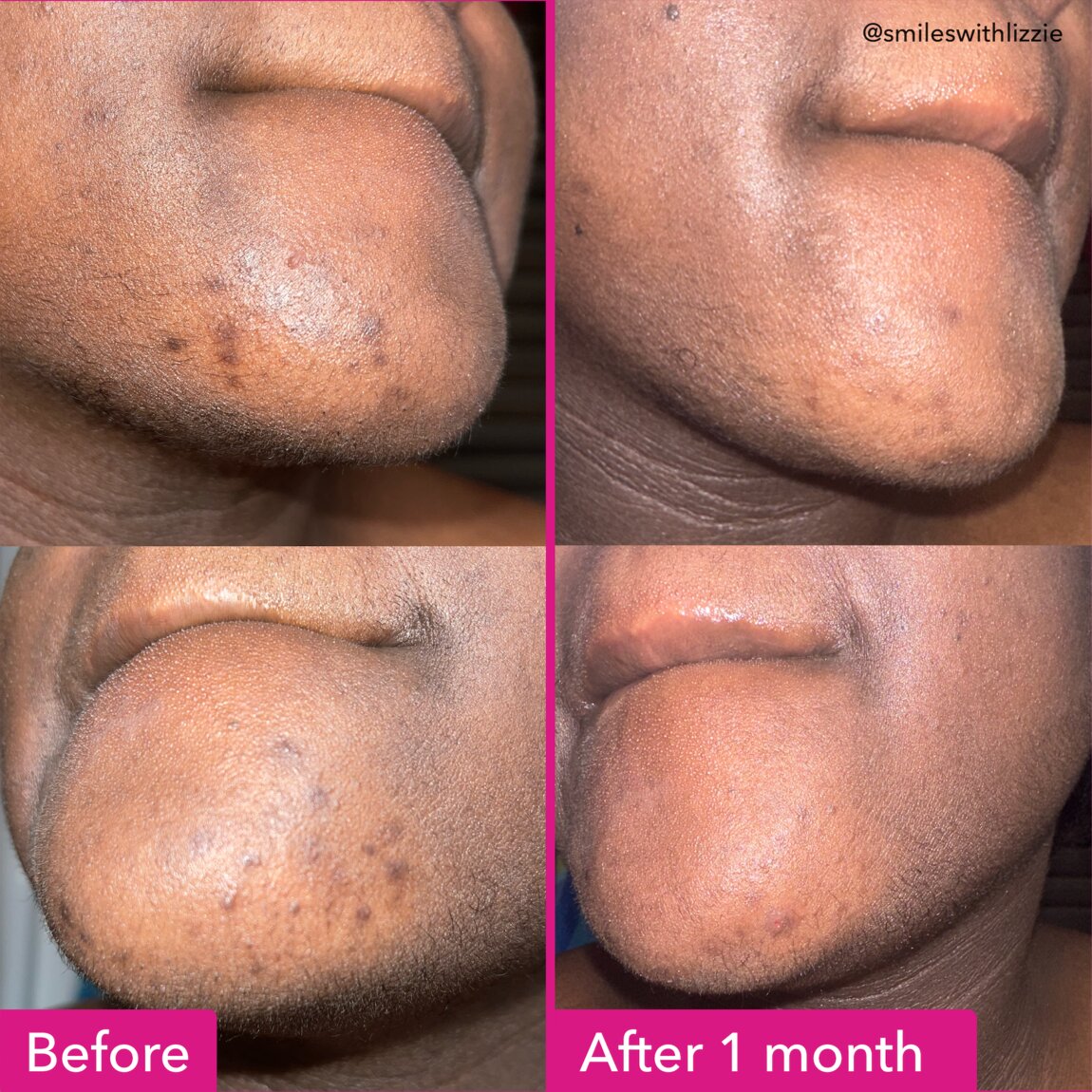 Brightening & Dark Spots Bar G0