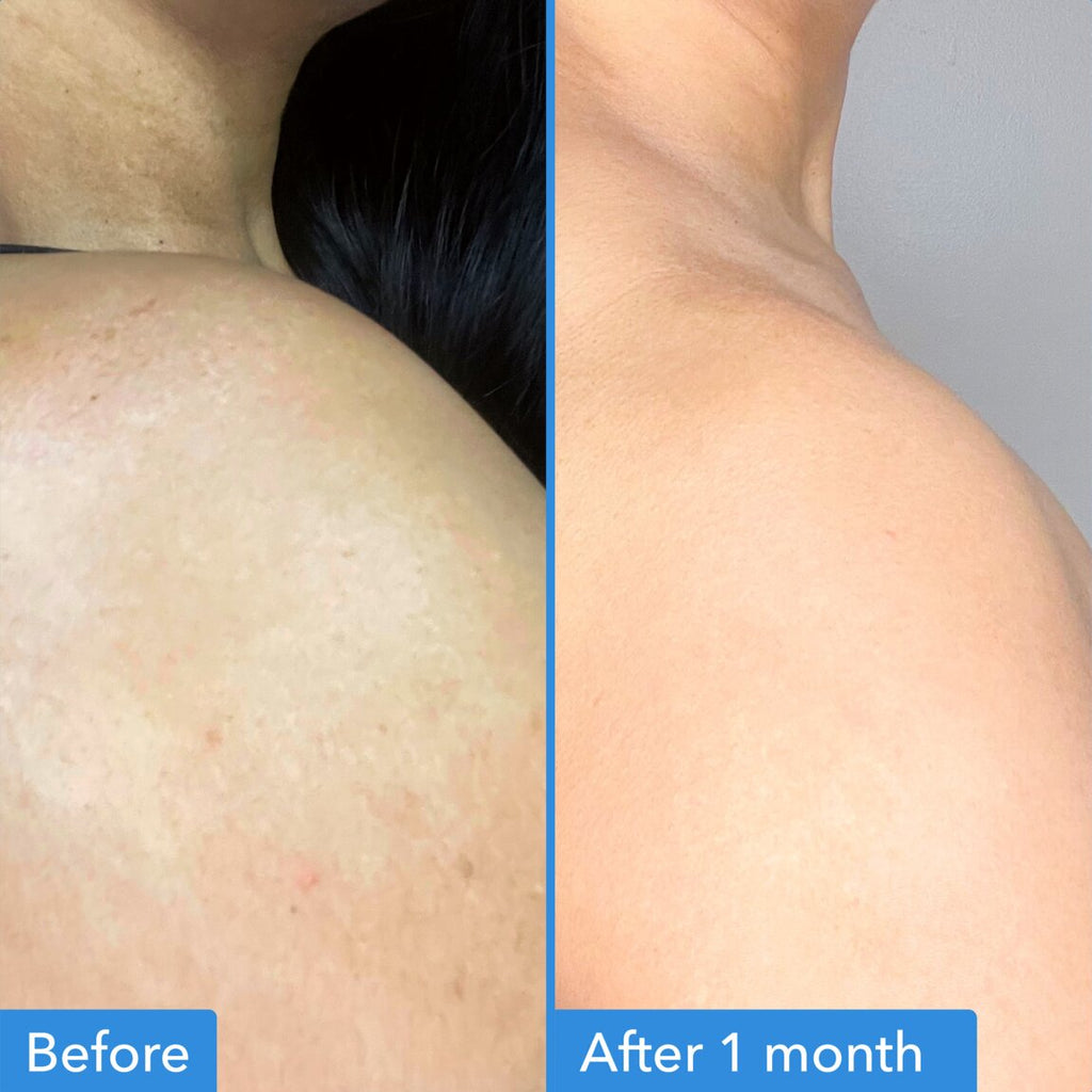 Discoloration Correcting Body Treatment B9