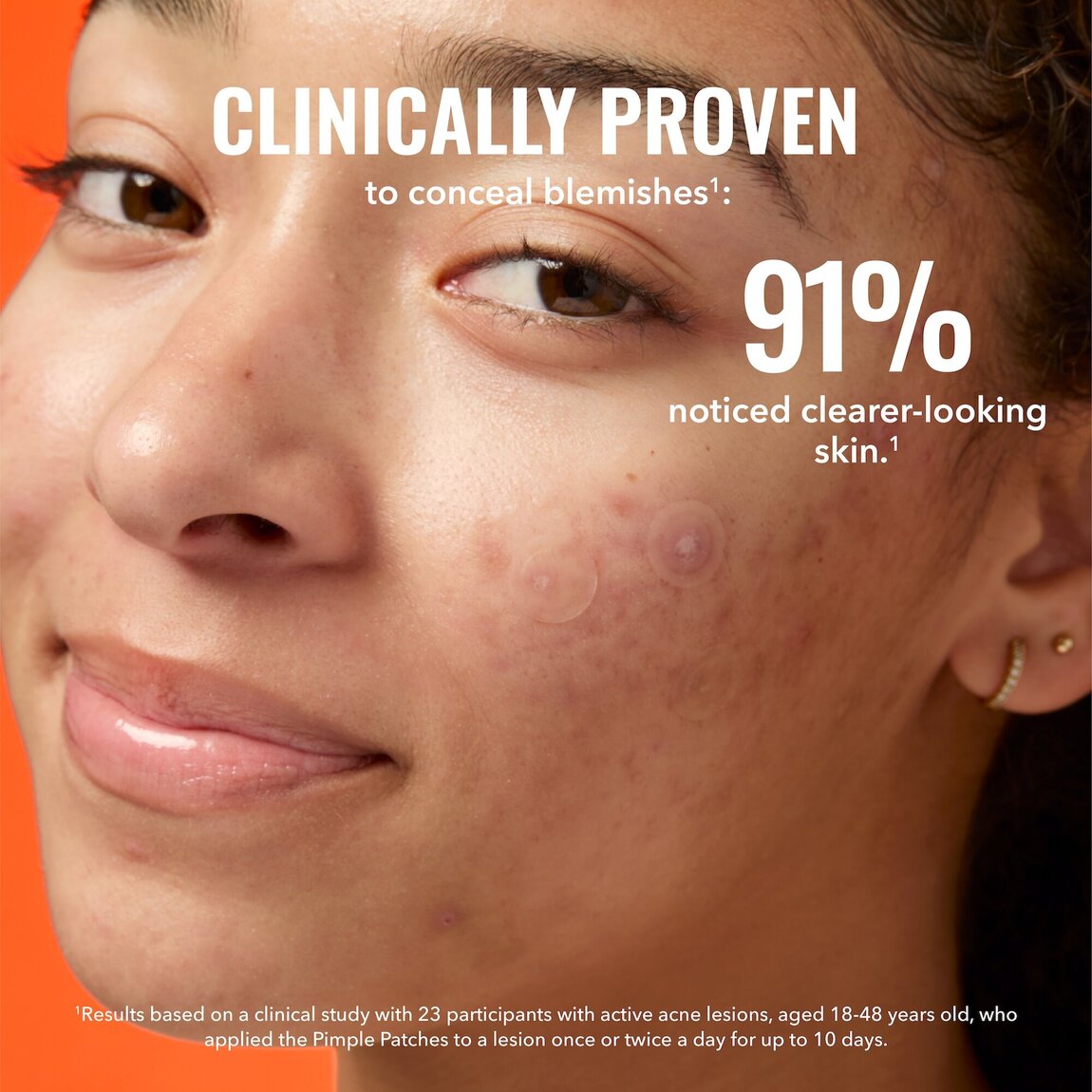 Pimple Patches O1