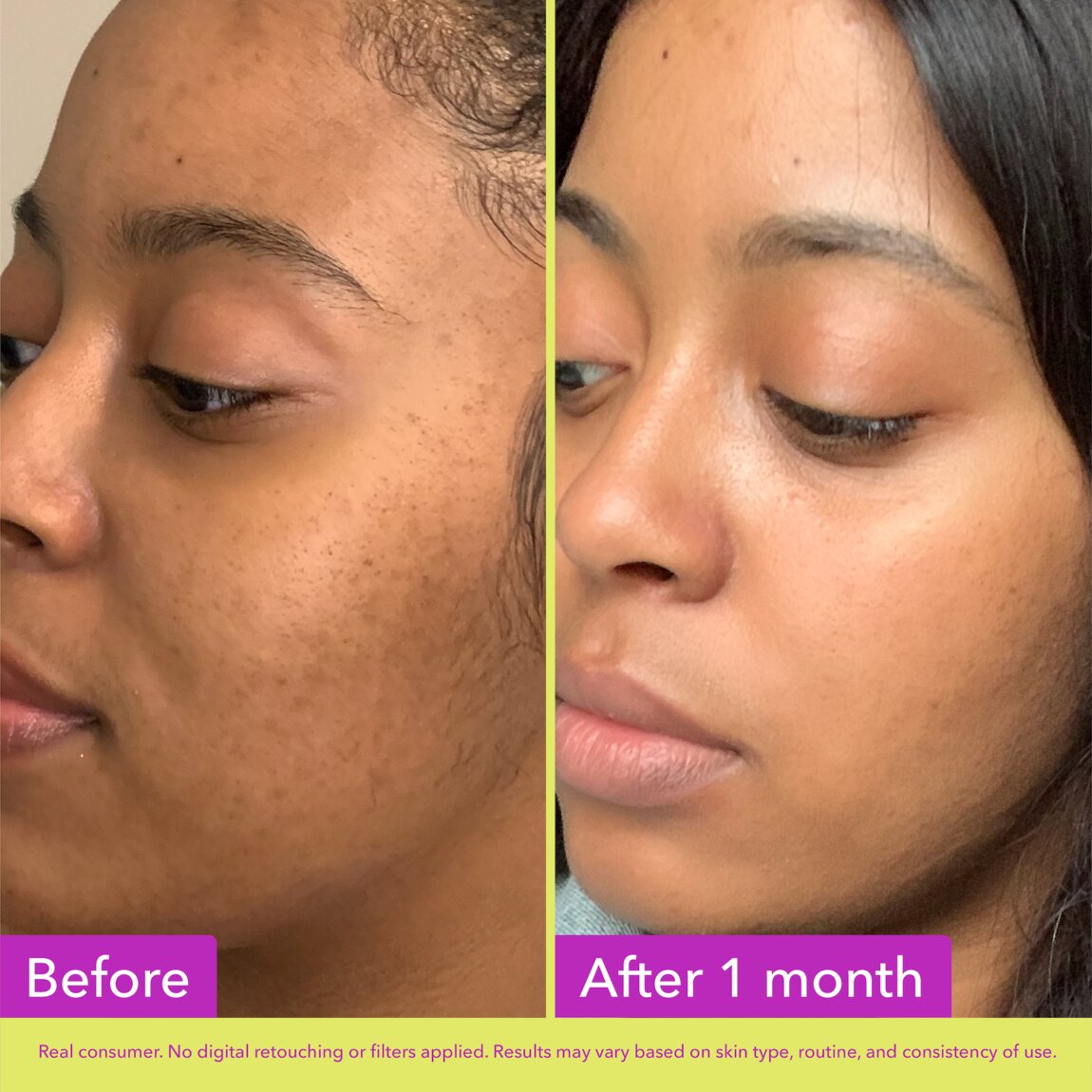 Glycolic Exfoliating Toner F1