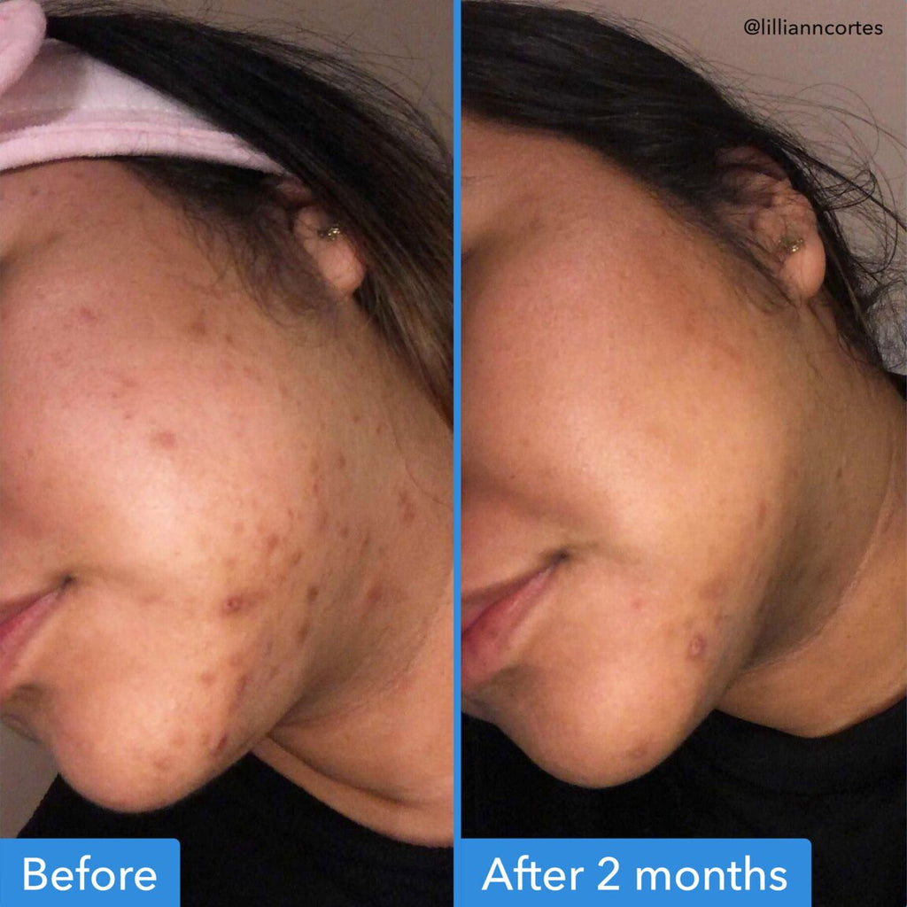 Discoloration Correcting Serum X5